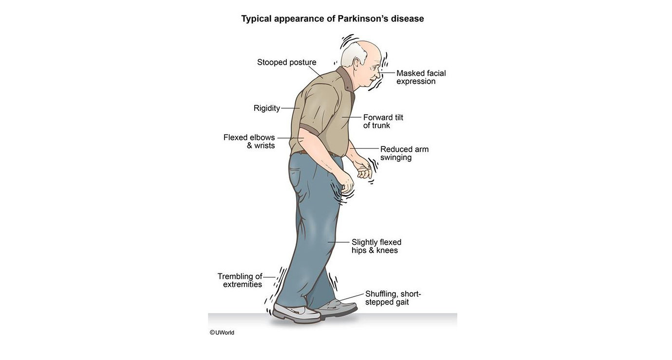 Диета При Болезни Паркинсона Правильное Питание Таблица