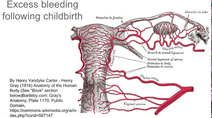 pendarahan postpartum