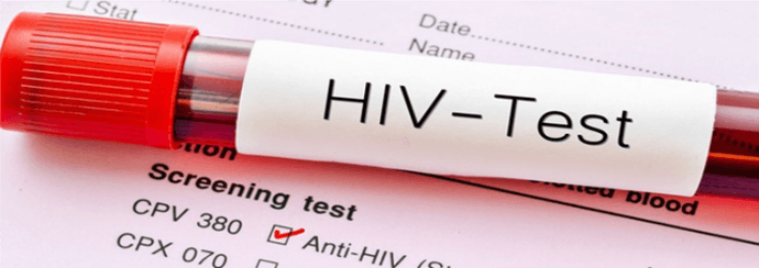 Dictio HIV
