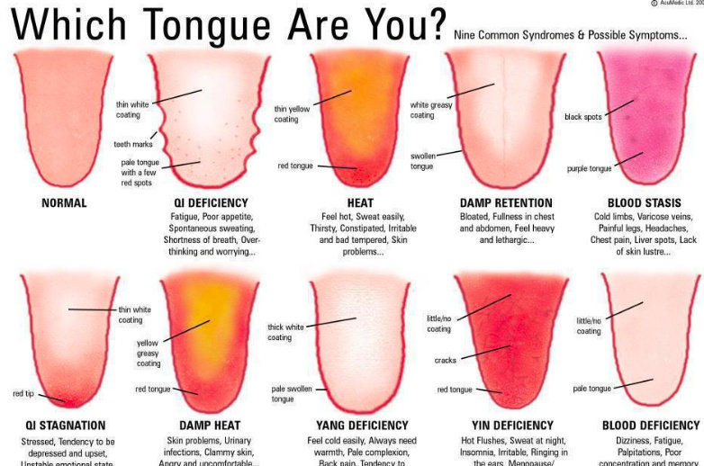 melihat kondisi kesehatan dari kondisi lidah kita