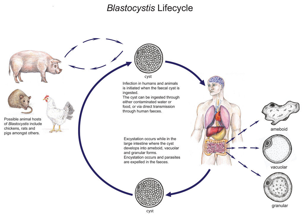 paraziti blastocystis)