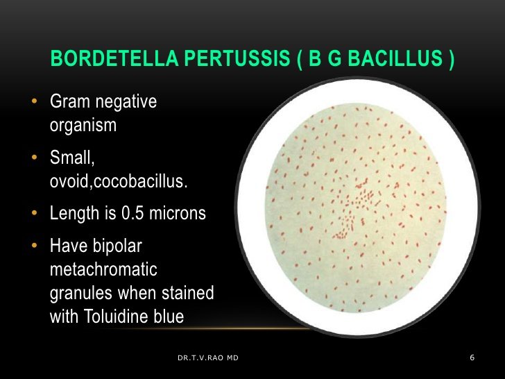 Bagaimanakah dampak dari bakteri bordetella pertussis terhadap manusia