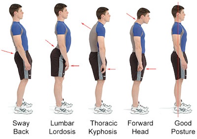 Body Posture
