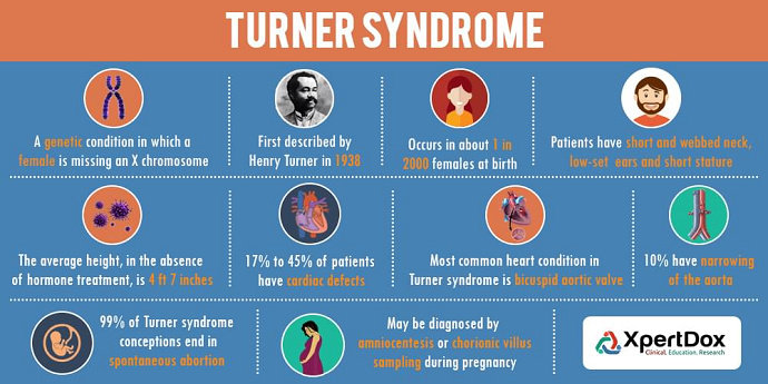 Sindrom Turner