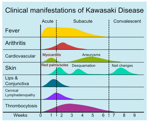 Perjalanan gejala pada Kawasaki Disease