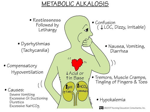 Gejala Alkalosis metabolik