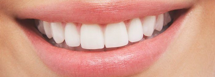Gigi putih
