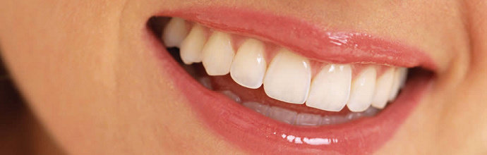 Gigi putih