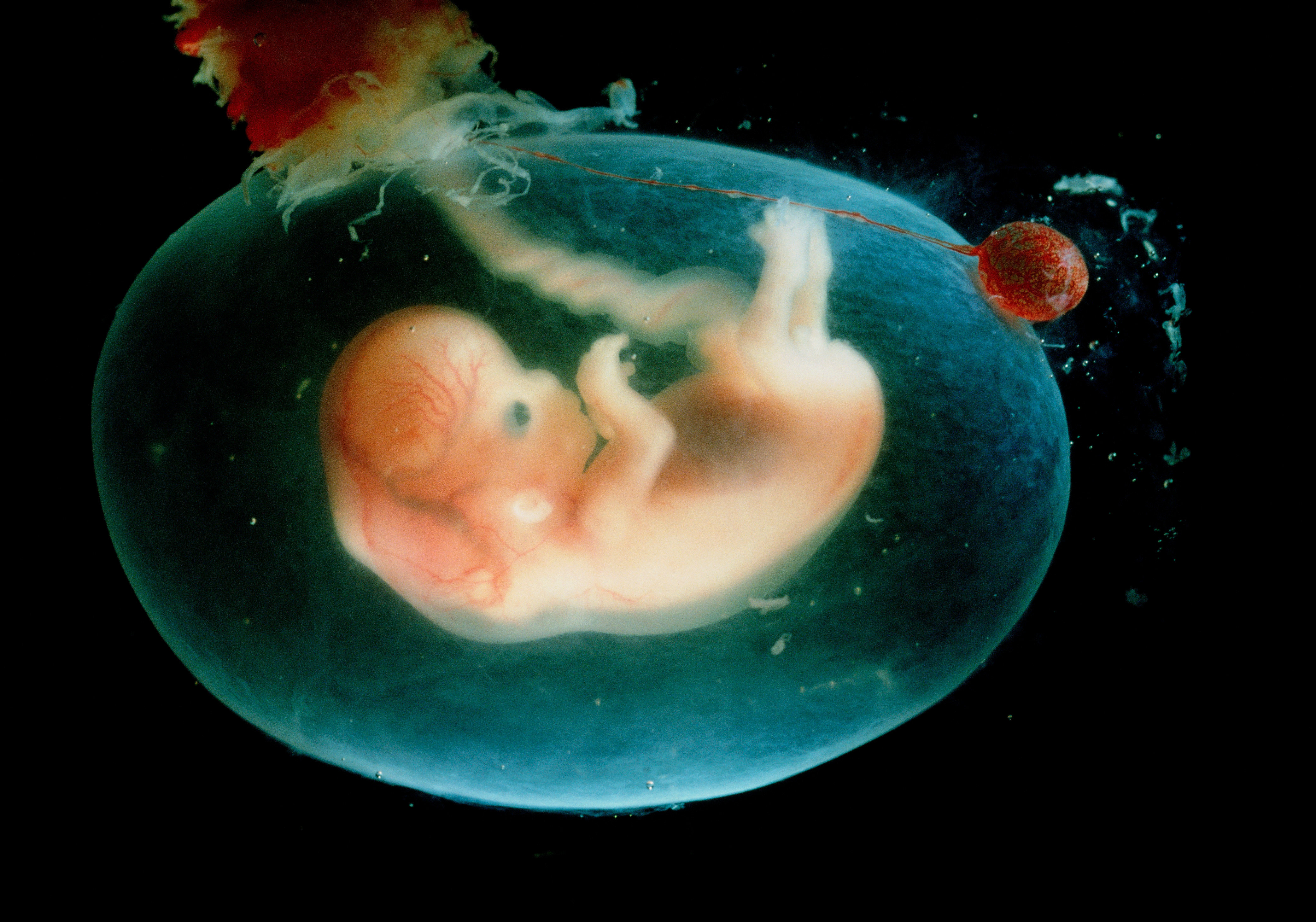 Ребенок ребенка 6 8 недель. Эмбрион человека 8 недель беременности. Зародыш человека 7-8 недель. Зародыш 8 недель беременности фото. Эмбрион человека 7 недель.