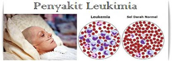 Gambar Leukimia