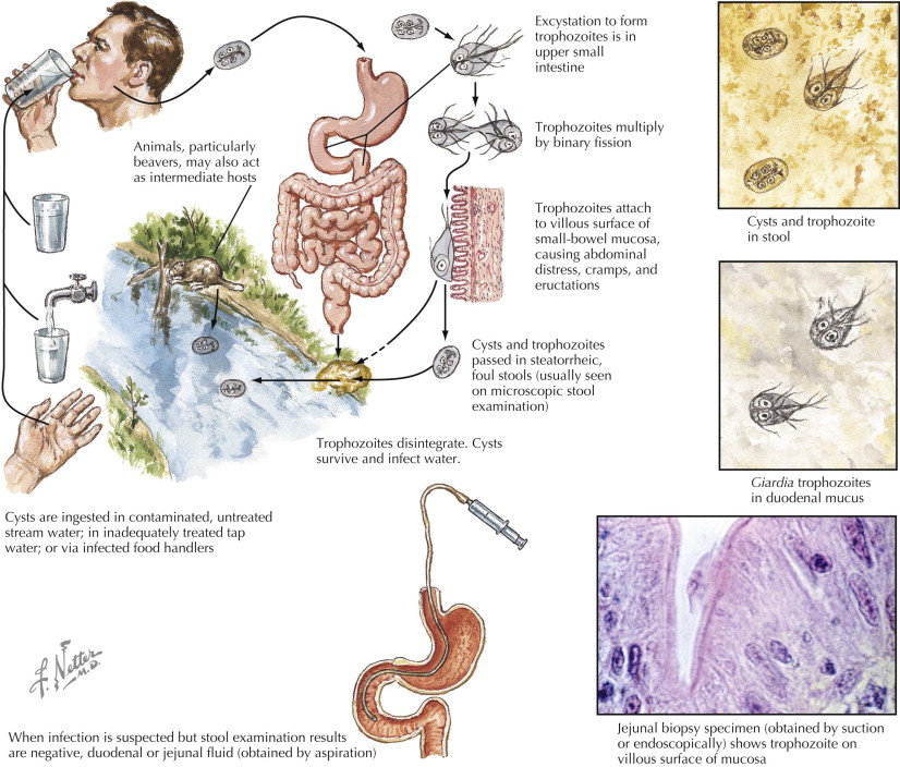 giardia și campylobacterul la om