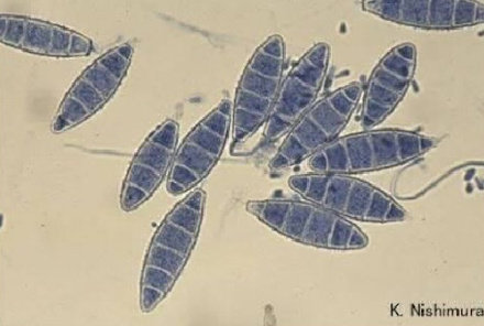 Morflogi Tinea flavus yang disebabkan oleh Microsporum gypseum