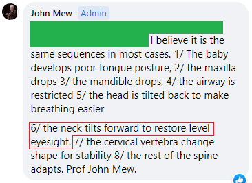 the neck tilts forward to restore level eyesight (or view) - John Mew (Vishal Malviya 2022 May 11 CAG)