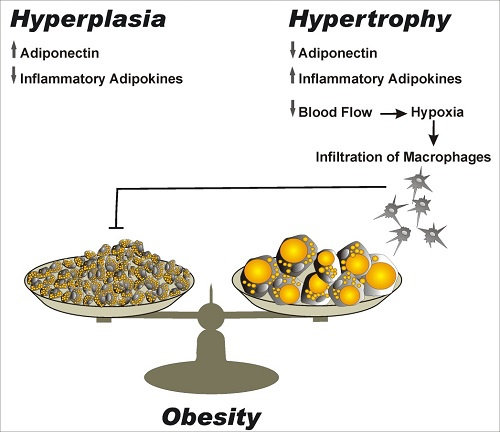 Hyperplasia dan Hypertropy pada obesitas