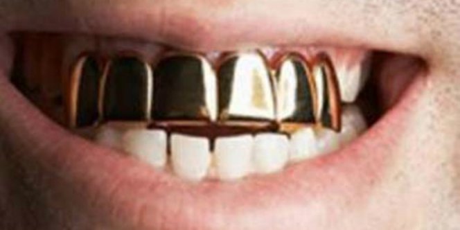 Gigi emas