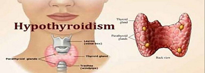 Hipotiroidisme adalah