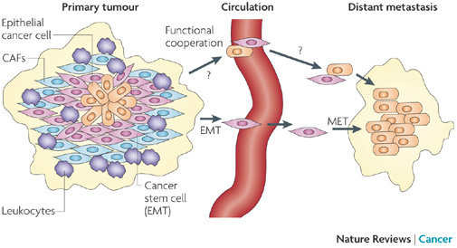 Metastasis kanker