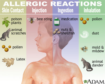 reaksi alergi