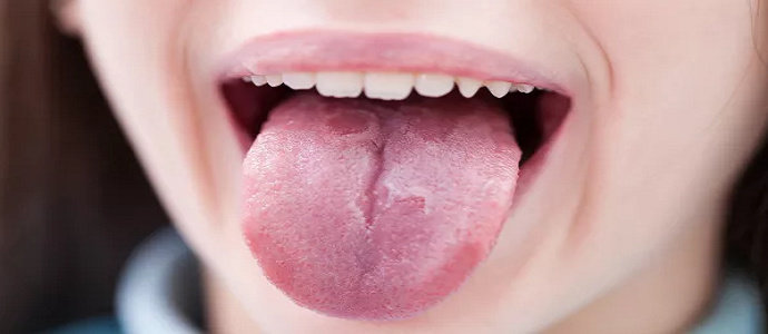 kondisi lidah mencerminkan kesehatan